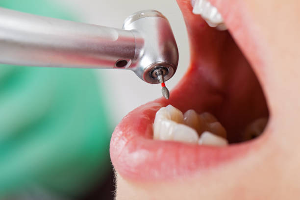 Best Emergency Gum Pain Relief  in North Vernon, IN